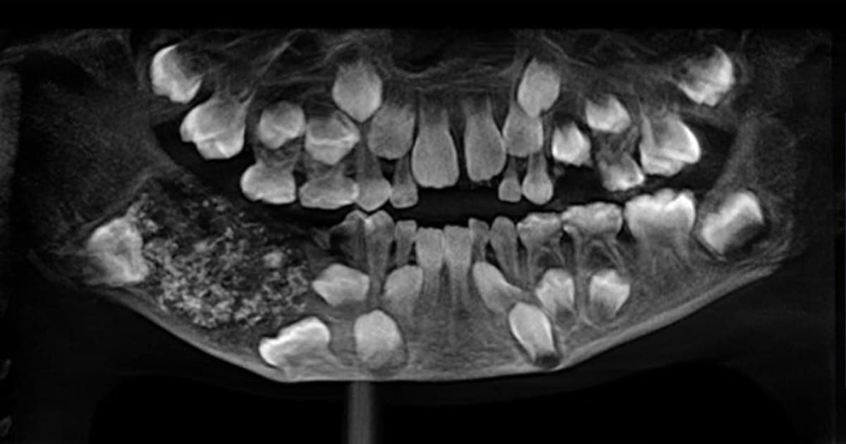 Representative image · Photo: media-cldnry.s-nbcnews.com